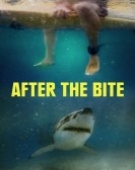 poster_after-the-bite_tt14746834.jpg Free Download