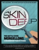 poster_skin-deep-the-battle-over-morgellons_tt10146070.jpg Free Download